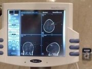 Neuronavegació per tractar amb més precisió els tumors cerebrals i l’estenosi lumbar