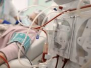 La malaltia renal crònica creix a Espanya amb més de 68.000 pacients en tractament renal substitutiu